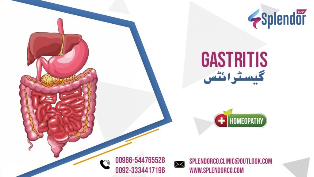 Homeopathic Remedies for Gastritis