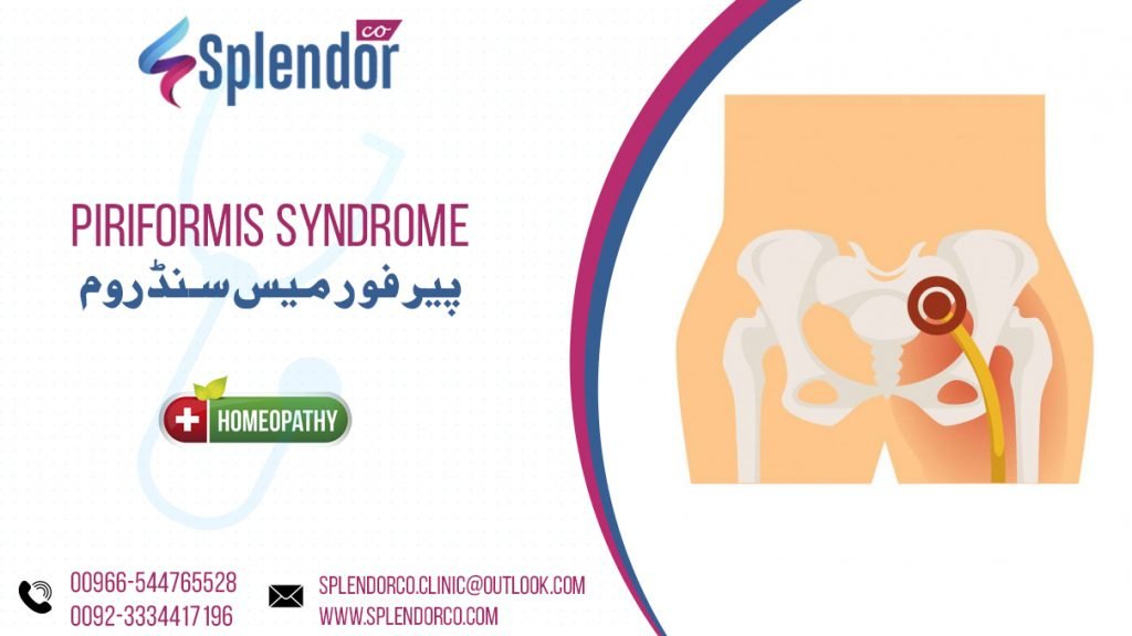 Homeopathic Medicines For Piriformis Syndrome